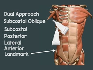 Landmark
Anterior
Lateral
Posterior
Subcostal
Subcostal Oblique
Dual Approach
 