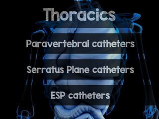 Thoracics
Paravertebral catheters
Serratus Plane catheters
ESP catheters
 