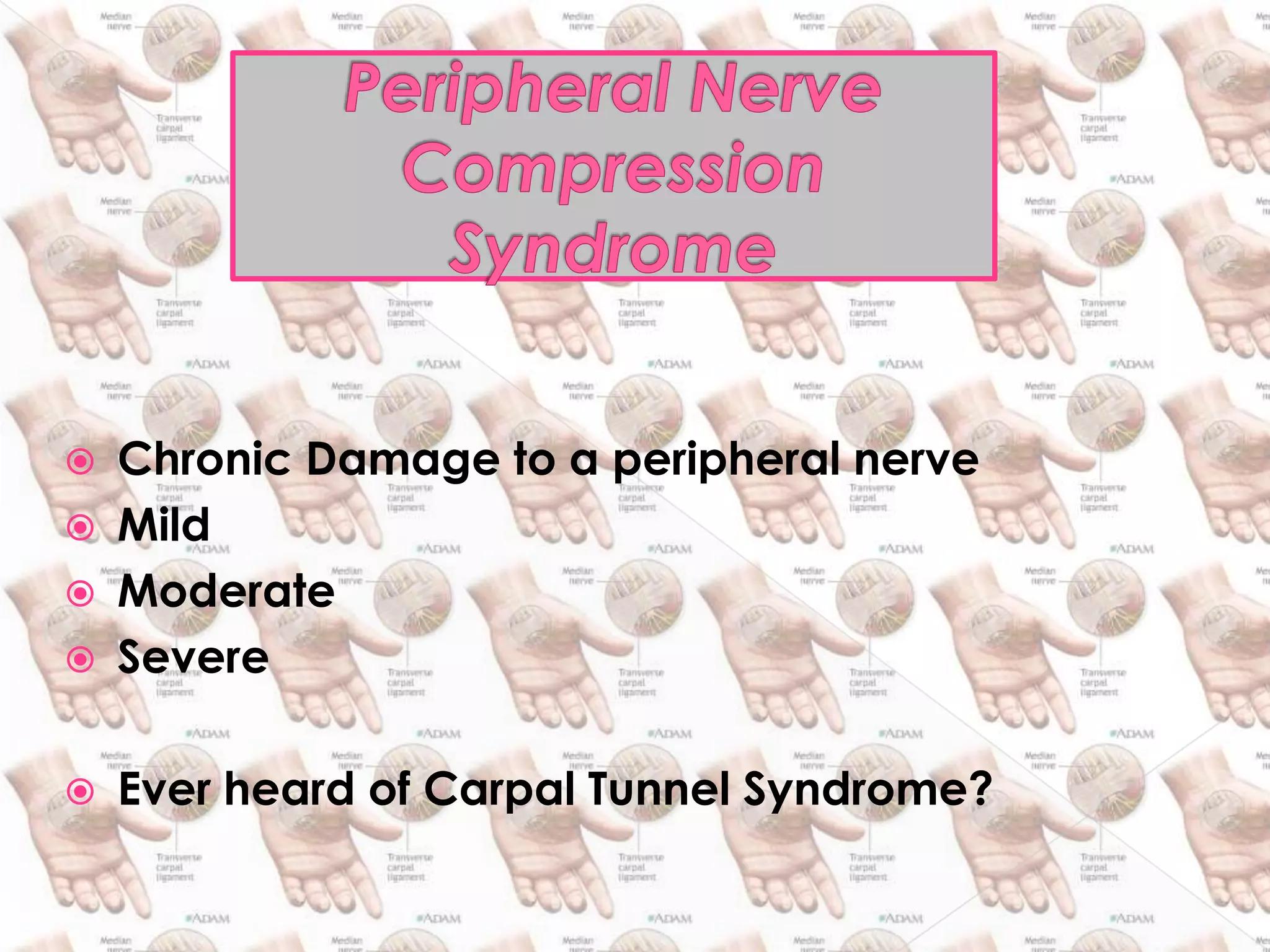 Peripheral Nerve CompressionSyndromeChronic Damage to a peripheral nerveMildModerateSevereEver heard of Carpal Tunnel Syndrome?