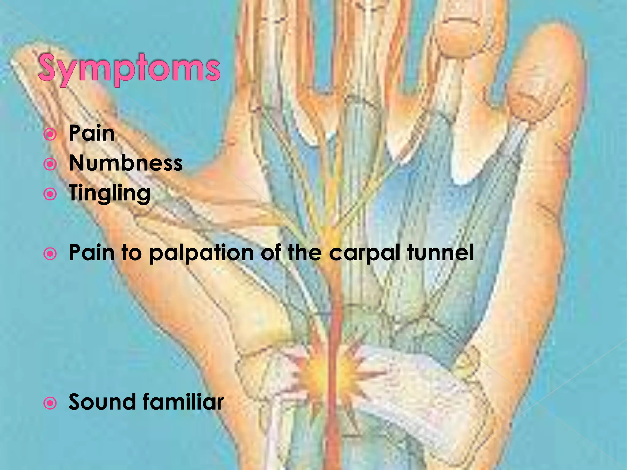 SymptomsPainNumbnessTinglingPain to palpation of the carpal tunnelSound familiar