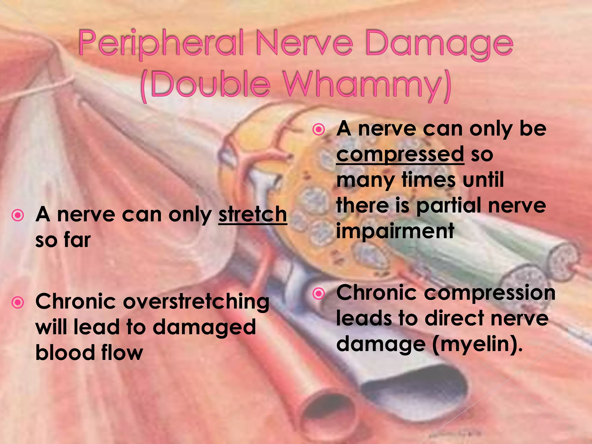Peripheral Nerve Damage(Double Whammy)A nerve can only stretch so farChronic overstretching will lead to damaged blood flowA nerve can only be compressed so many times until there is partial nerve impairmentChronic compression leads to direct nerve damage (myelin). 