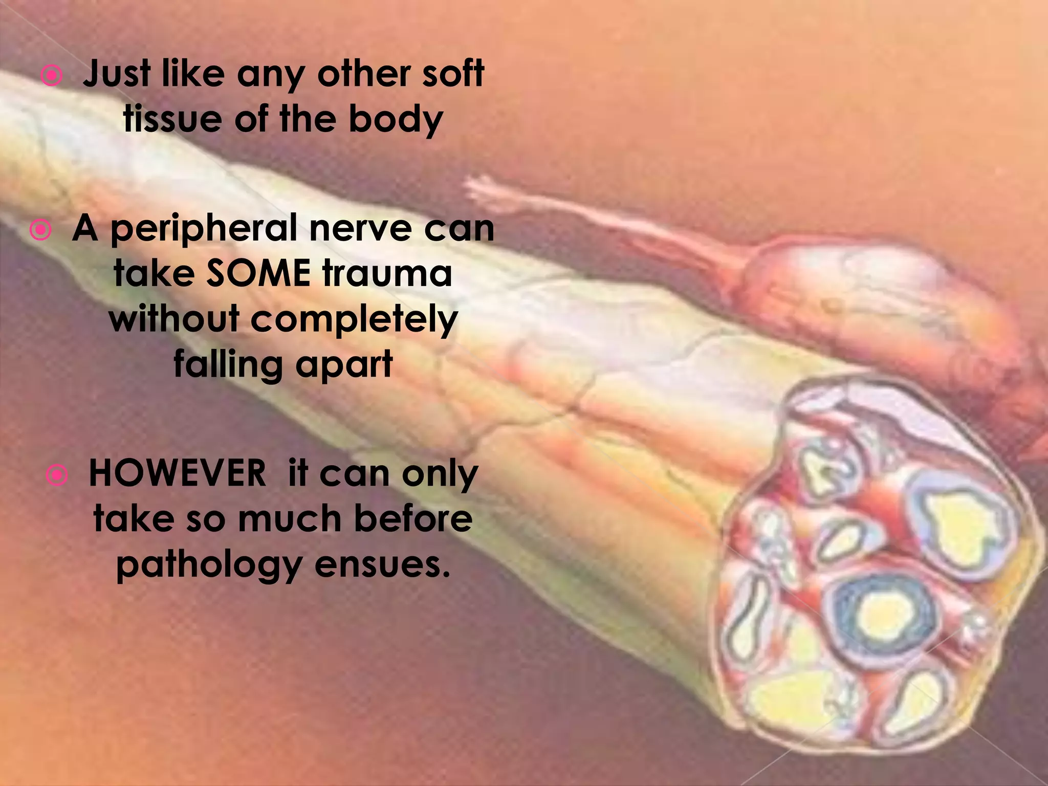 Just like any other soft tissue of the body A peripheral nerve can take SOME trauma without completely falling apartHOWEVER  it can only take so much before pathology ensues. 