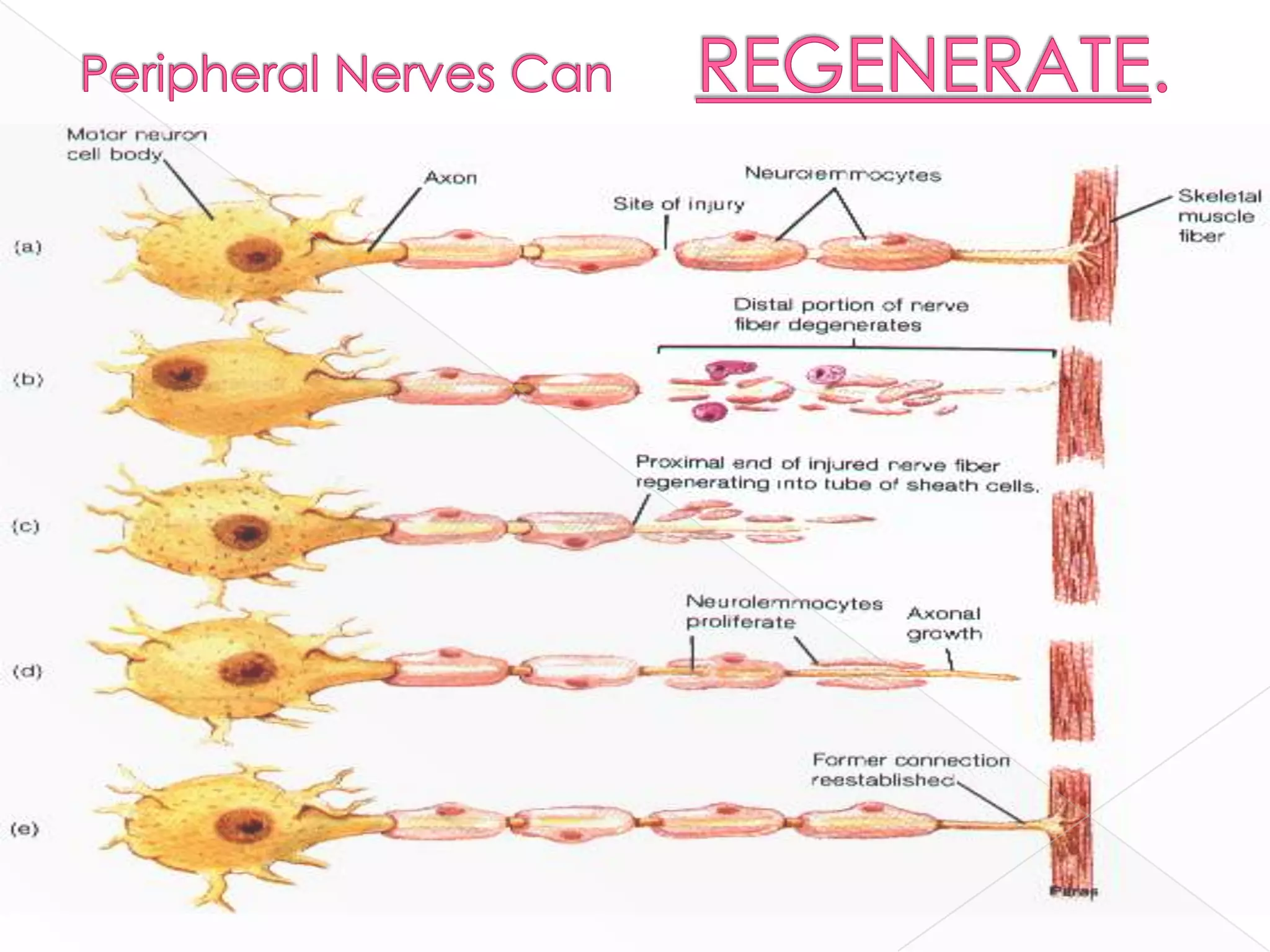 Peripheral Nerves Can      REGENERATE.