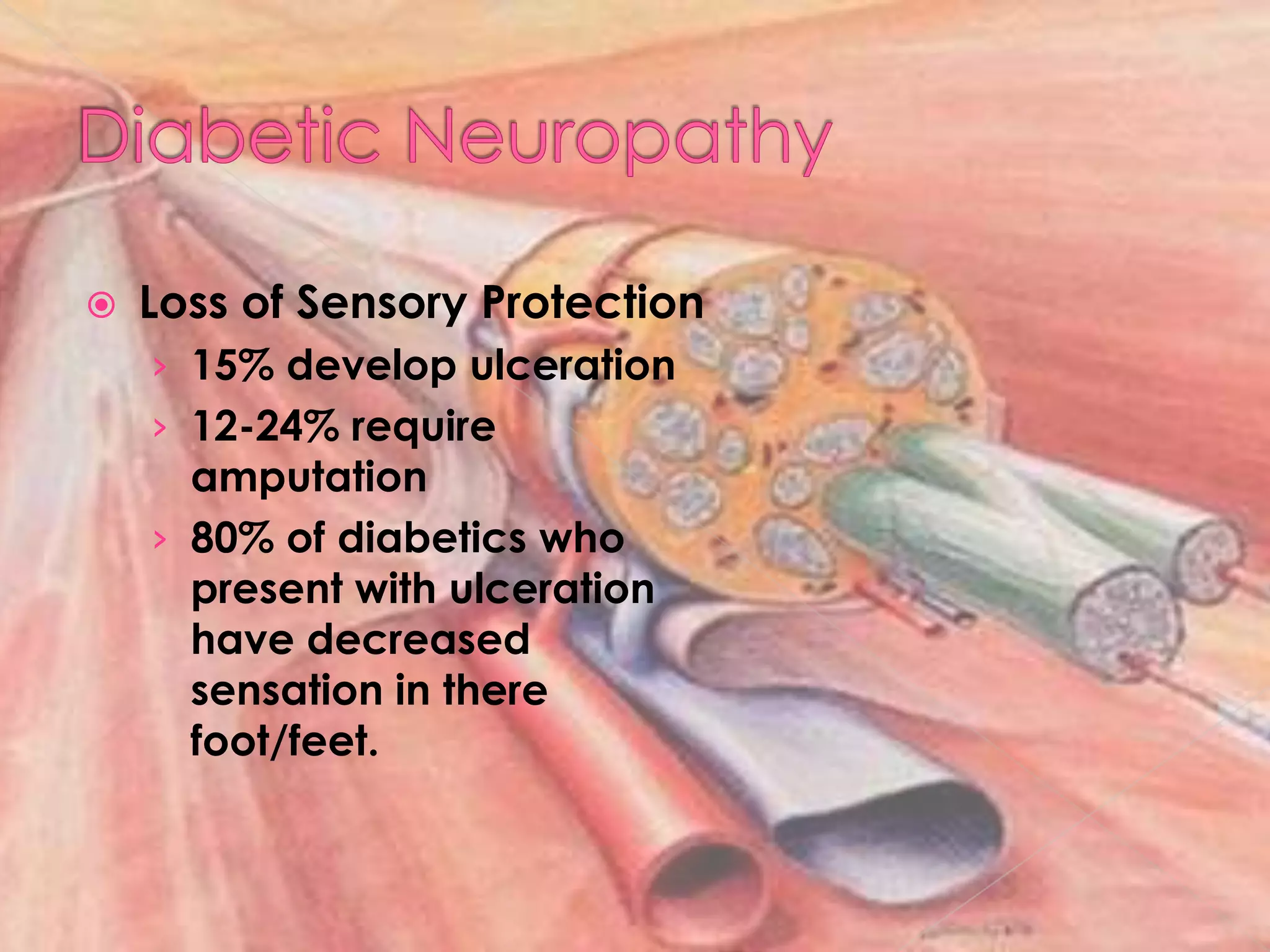 Diabetic NeuropathyLoss of Sensory Protection15% develop ulceration12-24% require amputation80% of diabetics who present with ulceration have decreased sensation in there foot/feet.