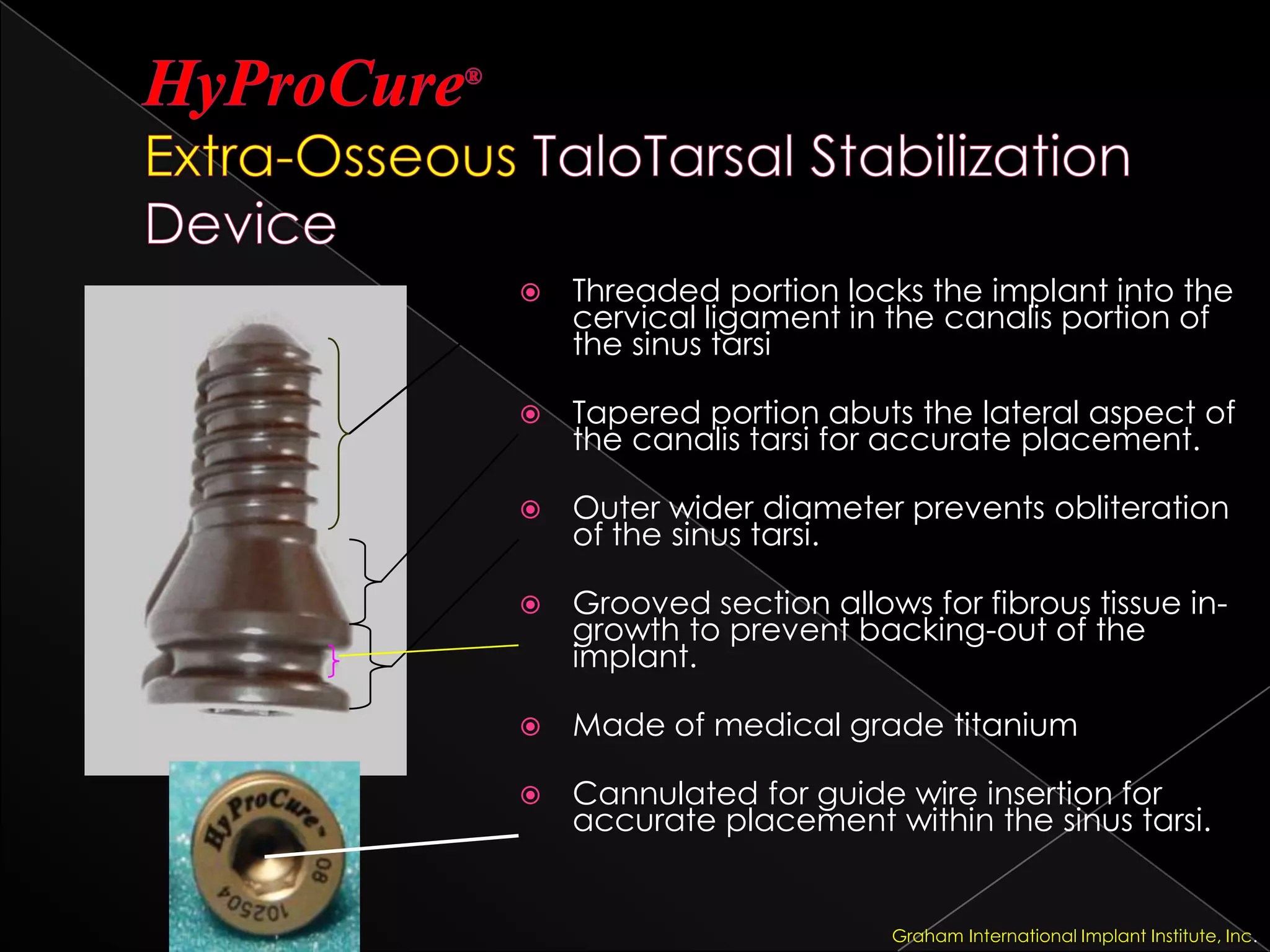 HyProCure®Extra-Osseous TaloTarsal Stabilization DeviceThreaded portion locks the implant into the cervical ligament in the canalis portion of the sinus tarsiTapered portion abuts the lateral aspect of the canalis tarsi for accurate placement.Outer wider diameter prevents obliteration of the sinus tarsi.Grooved section allows for fibrous tissue in-growth to prevent backing-out of the implant.Made of medical grade titaniumCannulated for guide wire insertion for accurate placement within the sinus tarsi.Graham International Implant Institute, Inc.