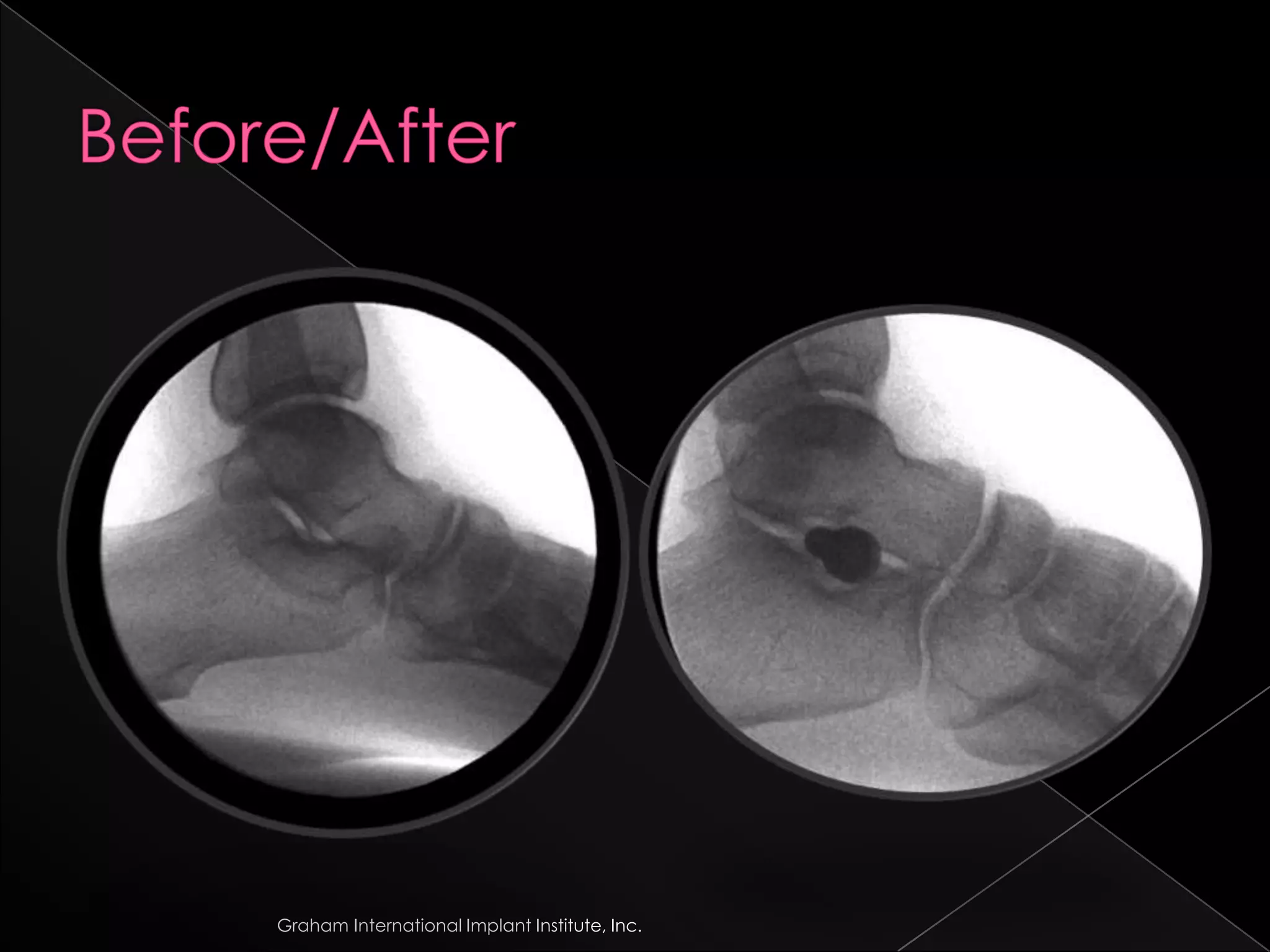Before/AfterGraham International Implant Institute, Inc.