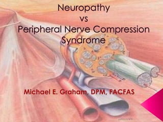 NeuropathyvsPeripheral Nerve Compression Syndrome Michael E. Graham, DPM, FACFAS 