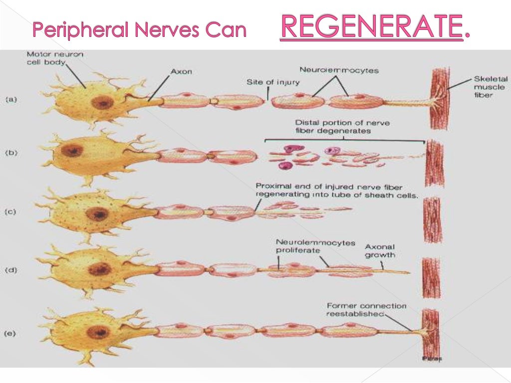 Peripheral Nerve Compression Syndrome
