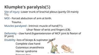 Klumpke's paralysis(5)
Site of injury -Lower trunk of brachial plexus (partly C8 mainly
T1).
MOI - Forced abduction of arm at birth.
Trauma .
Muscles paralyzed - Intrinsic muscle of hand(T1).
Ulnar flexor of wrist and fingers (C8).
Deformity - claw hand (hyperextension of MCP joint & flexion of
IP joint)
Disability -loss of biceps & supinator jerk
Complete claw hand
Cutaneous anaesthesia
Horner syndrome
 