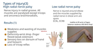Types of injury(3)
High radial nerve palsy Low radial nerve palsy
Nerve injury in radial groove. All
muscles are paralysed except triceps
and anconeus brachioradialis,
Results (1)
● Weakness and wasting of muscles
supplies
● Deformity-wrist drop -finger
flexed (weak extensor)
● Sensory loss on dorsum of hand
and forearm
● Loss of tricep reflex
Nerve is injured around elbow
and the muscles supplied by
radial nerve in distal arm are
spare
ECRL, ECRB
 