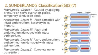 2. SUNDERLAND’S Classification(6)(3)(7)
Neurapraxia Degree I Caused by applying
pressure on nerve over short period.
Temporary conduction block,
Axonotmesis Degree II Axon damaged with
intact endoneurium. Recovery in 18
months.
Neurotmesis Degree III Axon and
endoneurium damaged with intact
perineurium.
Neurotmesis Degree IV Axon, endoneurium,
and perineurium damaged with intact
epineurium.
Neurotmesis Degree V Complete nerve
transection.
 