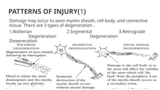 PATTERNS OF INJURY(1)
Damage may occur to axon myelin sheath, cell body, and connective
tissue. There are 3 types of degeneration .
1.Wallerian 2.Segmental 3.Retrograde
Degeneration Degeneration
Degeneration
 
