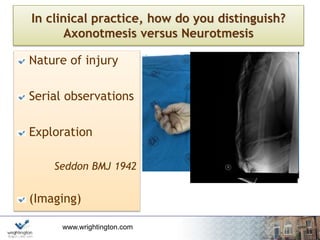 www.wrightington.com
In clinical practice, how do you distinguish?
Axonotmesis versus Neurotmesis
Nature of injury
Serial observations
Exploration
Seddon BMJ 1942
(Imaging)
 
