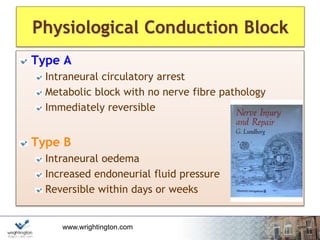 www.wrightington.com
Physiological Conduction Block
Type A
Intraneural circulatory arrest
Metabolic block with no nerve fibre pathology
Immediately reversible
Type B
Intraneural oedema
Increased endoneurial fluid pressure
Reversible within days or weeks
 