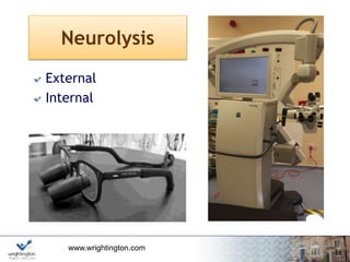 www.wrightington.com
Neurolysis
External
Internal
 