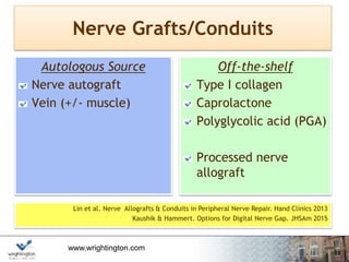 www.wrightington.com
Nerve Grafts/Conduits
Autologous Source
Nerve autograft
Vein (+/- muscle)
Off-the-shelf
Type I collagen
Caprolactone
Polyglycolic acid (PGA)
Processed nerve
allograft
Lin et al. Nerve Allografts & Conduits in Peripheral Nerve Repair. Hand Clinics 2013
Kaushik & Hammert. Options for Digital Nerve Gap. JHSAm 2015
 