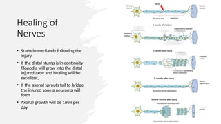Comprehensive Overview of Peripheral Nerve Injuries: Anatomy, Diagnosis ...