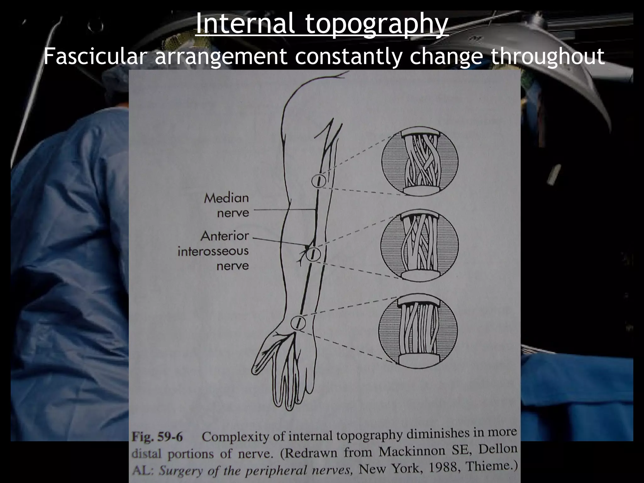 Internal topography
Fascicular arrangement constantly change throughout
                     the course
 