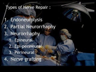 Types of Nerve Repair :

1. Endoneurolysis
2. Partial Neurorrhaphy
3. Neurorrhaphy
  1. Epineural
  2. Epi-perineural
  3. Perineural
4. Nerve grafting
 