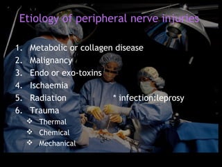 Etiology of peripheral nerve injuries

1.   Metabolic or collagen disease
2.   Malignancy
3.   Endo or exo-toxins
4.   Ischaemia
5.   Radiation            * infection:leprosy
6.   Trauma
      Thermal
      Chemical
      Mechanical
 