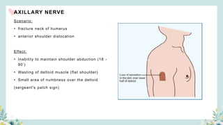 AXILLARY NERVE
Scenario:
• fracture neck of humerus
• anterior shoulder dislocation
Effect:
• Inability to maintain shoulder abduction (18 -
90’)
• Wasting of deltoid muscle (flat shoulder)
• Small area of numbness over the deltoid
(sergeant's patch sign)
 