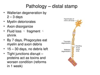 Pathology – distal stamp
• Wallerian degeneration by
2 – 3 days
• Myelin detoriorates
• Axon disorganize
• Fluid loss  fragment 
shrink
• By 7 days, Phagocytes eat
myelin and axon debris
• 15 – 30 days, no debris left
• Tight junctions disrupt –
proteins act as toxins and
worsen condition (reforms
in 1 week)
 
