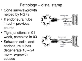 Pathology – distal stamp
• Cone survival/growth
helped by NGFs
• If endoneural tube
intact – previous
course
• Tight junctions in 01
week, complete in 03
• Schwann cells, and
endoneural tubes
degenerate 18 – 24
mo – re-growth
ceases
 