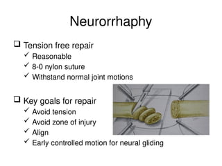 Neurorrhaphy
 Tension free repair
 Reasonable
 8-0 nylon suture
 Withstand normal joint motions
 Key goals for repair
 Avoid tension
 Avoid zone of injury
 Align
 Early controlled motion for neural gliding
 
