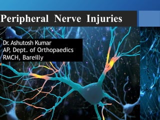 Peripheral Nerve Injuries
Dr.Ashutosh Kumar
AP, Dept. of Orthopaedics
RMCH, Bareilly
 