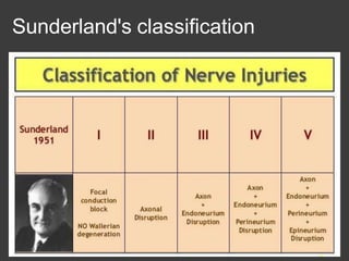 Sunderland's classification
 
