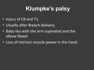 Klumpke’s palsy
• Injury of C8 and T1.
• Usually after Breech delivery.
• Baby lies with the arm supinated and the
elbow flexed
• Loss of intrinsic muscle power in the hand.
 