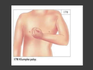 Peripheral Nerve Injury (Part-I)