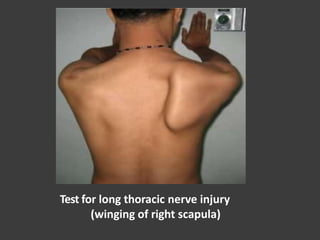 Test for long thoracic nerve injury
(winging of right scapula)
 