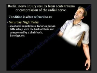 Peripheral Nerve Injury (Part-I)