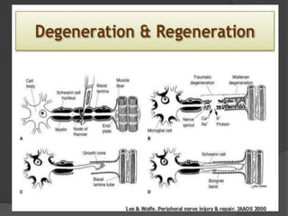 Peripheral Nerve Injury (Part-I)