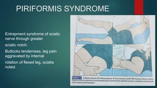 PIRIFORMIS SYNDROME
Entrapment syndrome of sciatic
nerve through greater
sciatic notch.
Buttocks tenderness, leg pain
aggravated by internal
rotation of flexed leg, sciatia
noted.
 