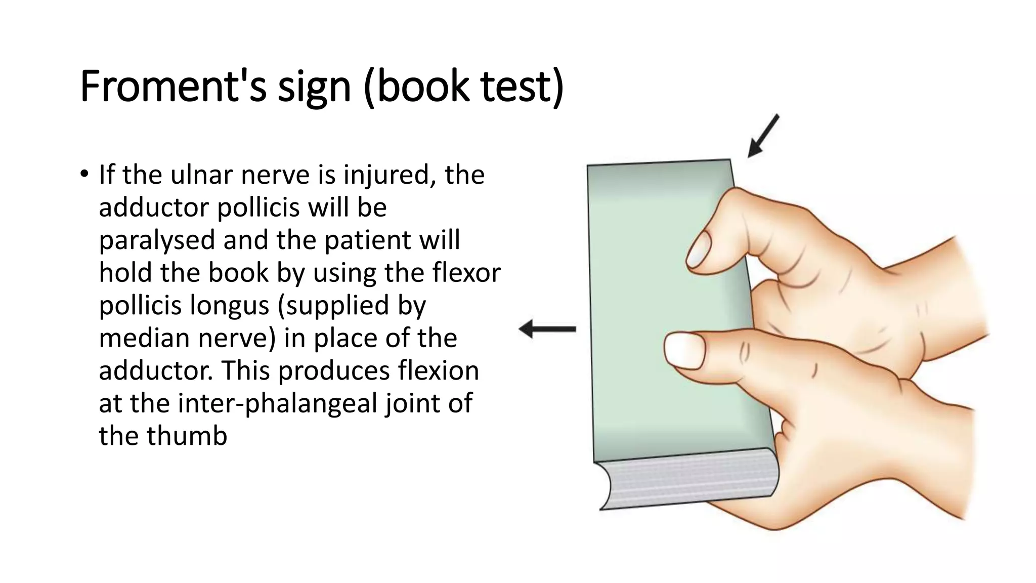 Peripheral nerve injuries of upper limb | PPTX