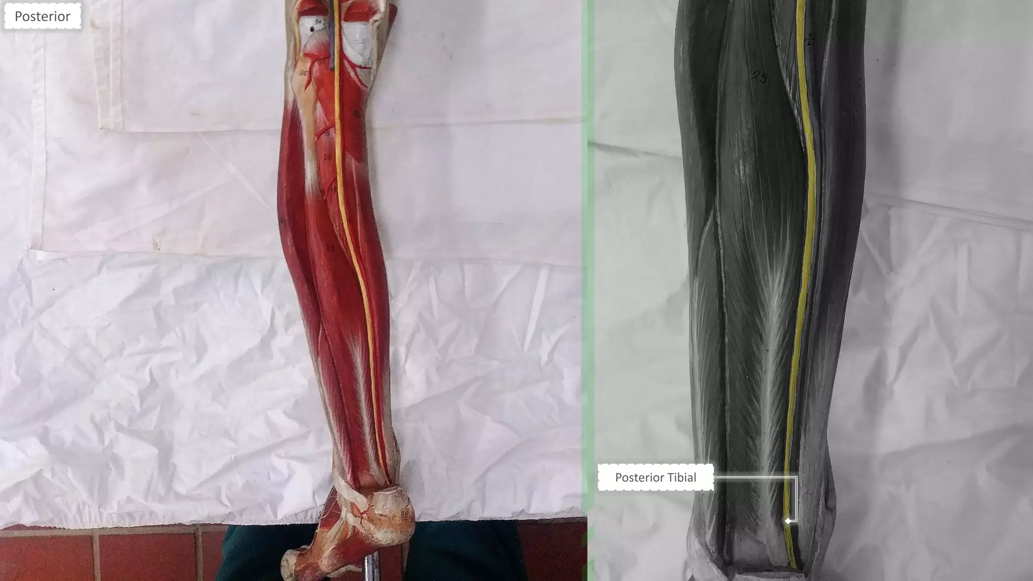 Posterior Tibial
Posterior
 