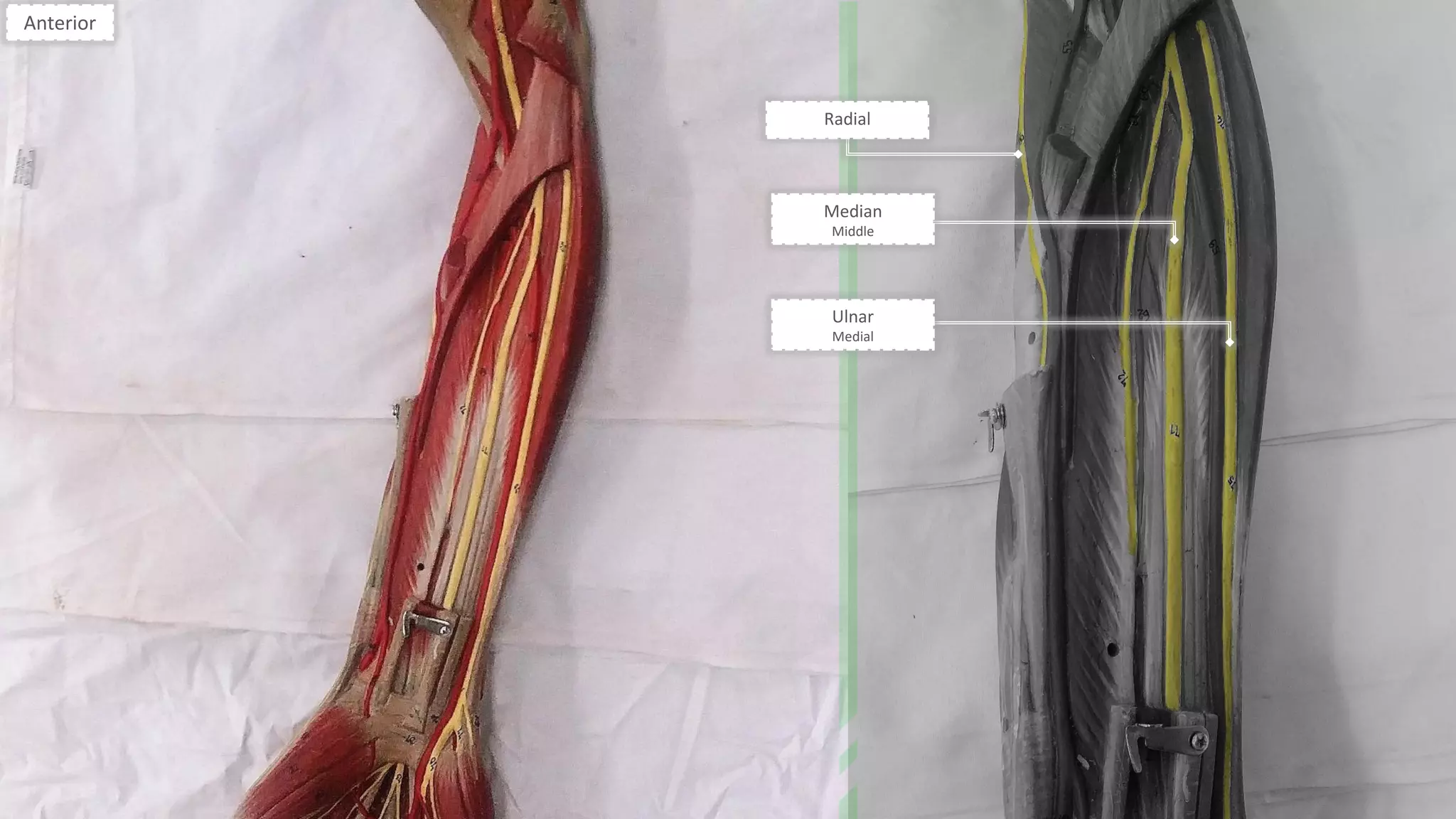 Radial
Anterior
Median
Middle
Ulnar
Medial
 