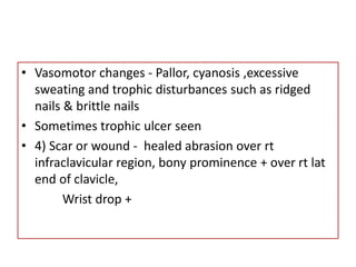 • Vasomotor changes - Pallor, cyanosis ,excessive
sweating and trophic disturbances such as ridged
nails & brittle nails
• Sometimes trophic ulcer seen
• 4) Scar or wound - healed abrasion over rt
infraclavicular region, bony prominence + over rt lat
end of clavicle,
Wrist drop +
 