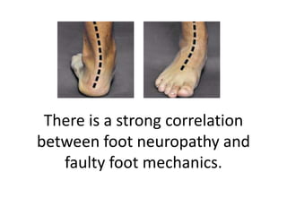 There is a strong correlation
between foot neuropathy and
faulty foot mechanics.
 