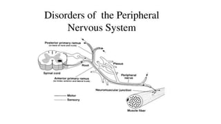 Peripheral neuropathy | PPTX