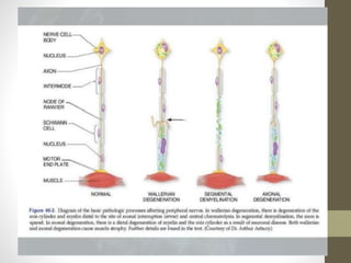 Approach to Peripheral neuropathy | PPTX