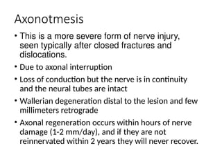 PERIPHERAL NEUROPATHY -WPS Office.pptxx | PPTX