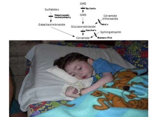 Peripheral neuropathy in systemic disease children | PPTX