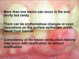 • More than one lesion can occur in the oral
cavity but rarely .
• There can be erythematous changes or even
ulcerations on the surface epithelium which
result from trauma.
• Consistency of the lesion varies,since lesions
may occur with ossification or without
ossification
 