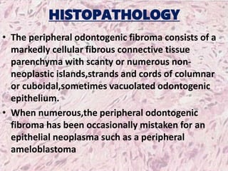 HISTOPATHOLOGY
• The peripheral odontogenic fibroma consists of a
markedly cellular fibrous connective tissue
parenchyma with scanty or numerous non-
neoplastic islands,strands and cords of columnar
or cuboidal,sometimes vacuolated odontogenic
epithelium.
• When numerous,the peripheral odontogenic
fibroma has been occasionally mistaken for an
epithelial neoplasma such as a peripheral
ameloblastoma
 