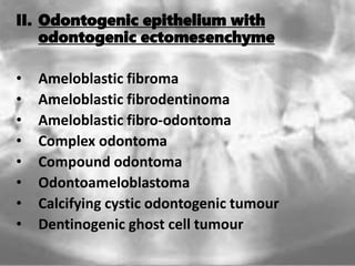 II. Odontogenic epithelium with
odontogenic ectomesenchyme
• Ameloblastic fibroma
• Ameloblastic fibrodentinoma
• Ameloblastic fibro-odontoma
• Complex odontoma
• Compound odontoma
• Odontoameloblastoma
• Calcifying cystic odontogenic tumour
• Dentinogenic ghost cell tumour
 