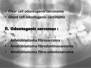 • Clear cell odontogenic carcinoma
• Ghost cell odontogenic carcinoma
II. Odontogenic sarcomas :
• Ameloblastoma fibrosarcoma
• Ameloblastoma fibrodentinosarcoma
• Ameloblastoma fibro-odontosarcoma
 