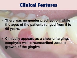 Clinical Features
• There was no gender predilection, while
the ages of the patients ranged from 5 to
65 years.
• Clinically appears as a show enlarging,
exophytic well-circumscribed ,sessile
growth of the gingiva.
 